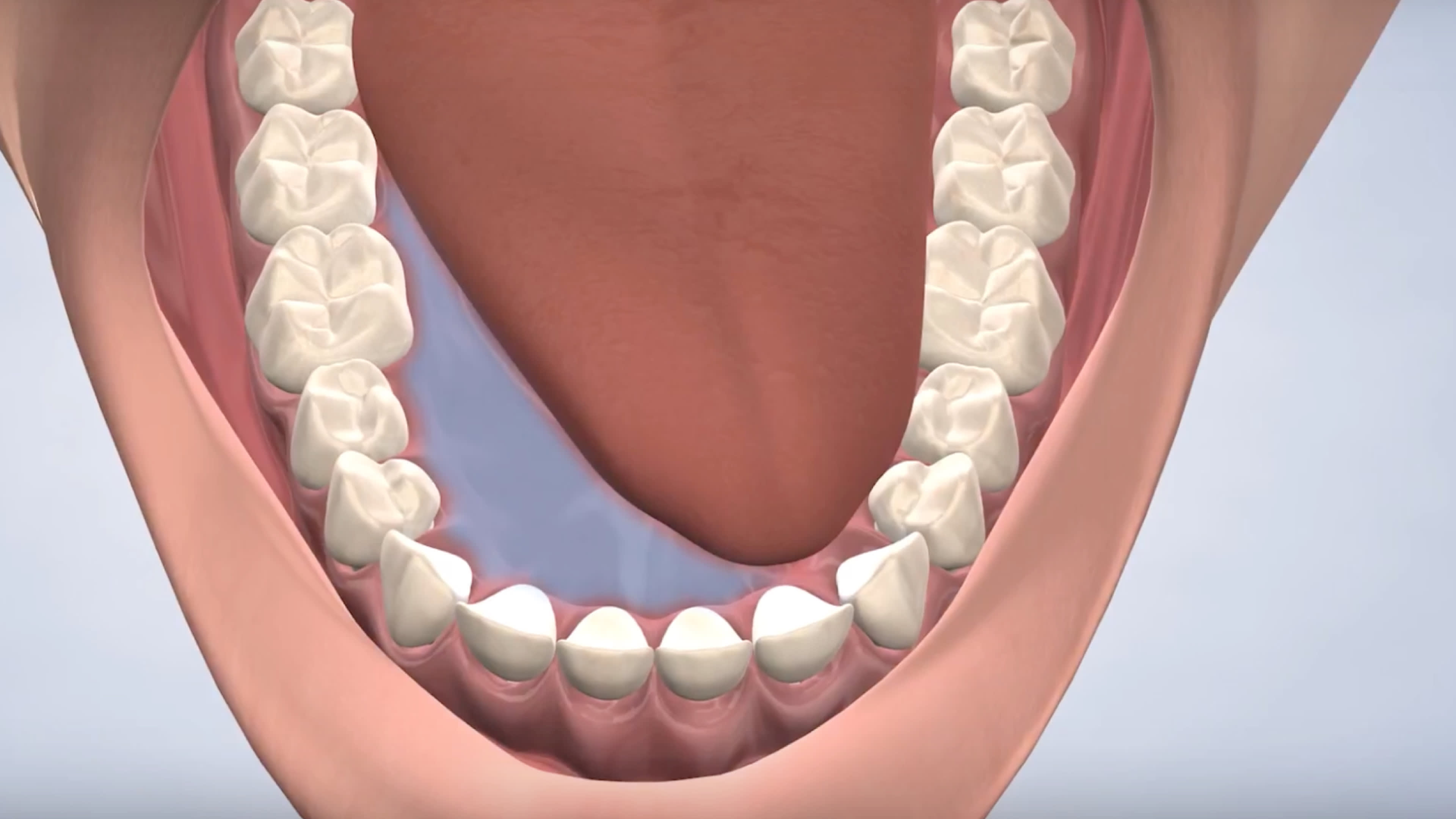 Illustration of oral pathology