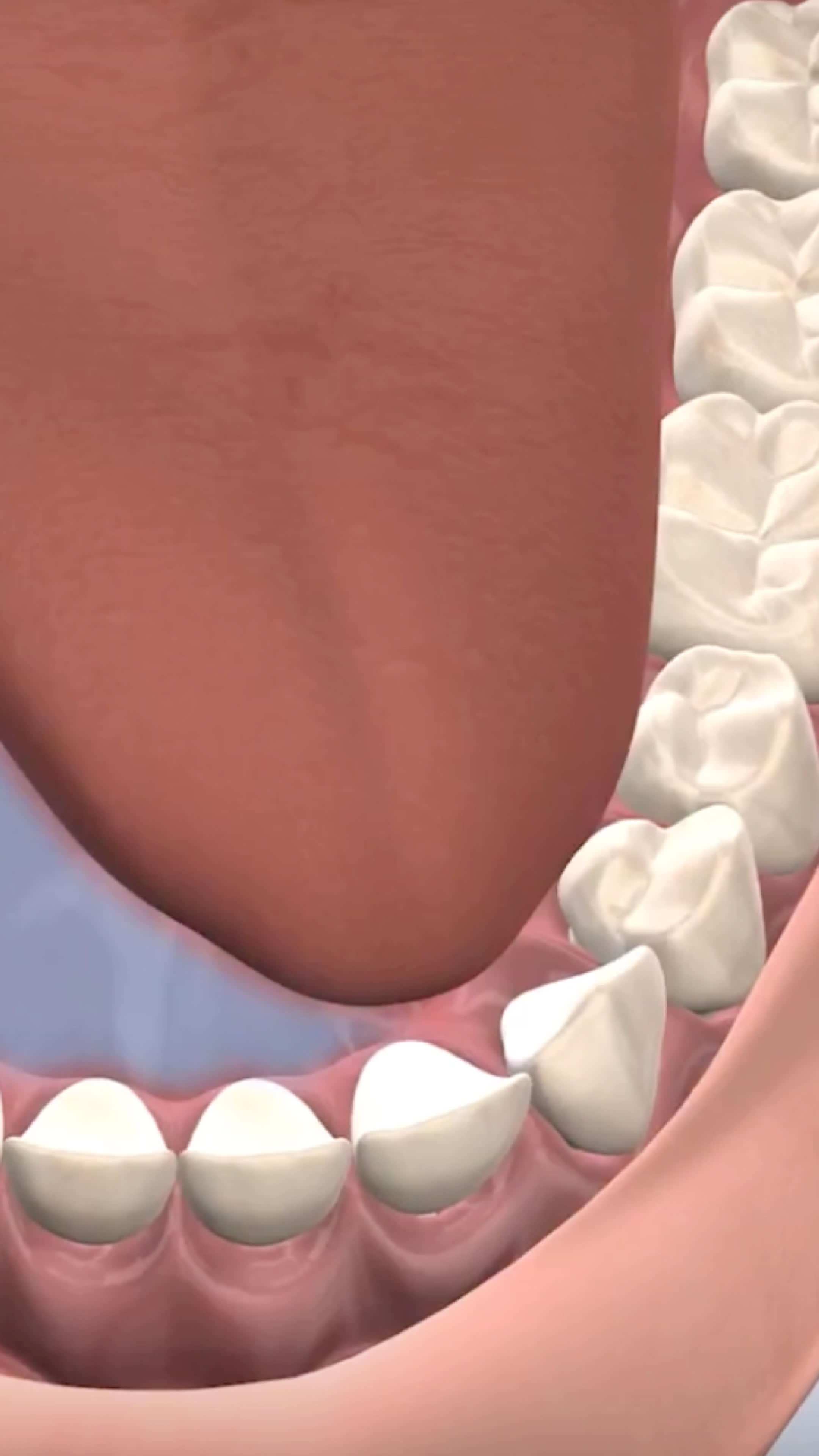 Illustration of oral pathology